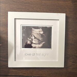 White 'Love at First Sight' Ultrasound Frame